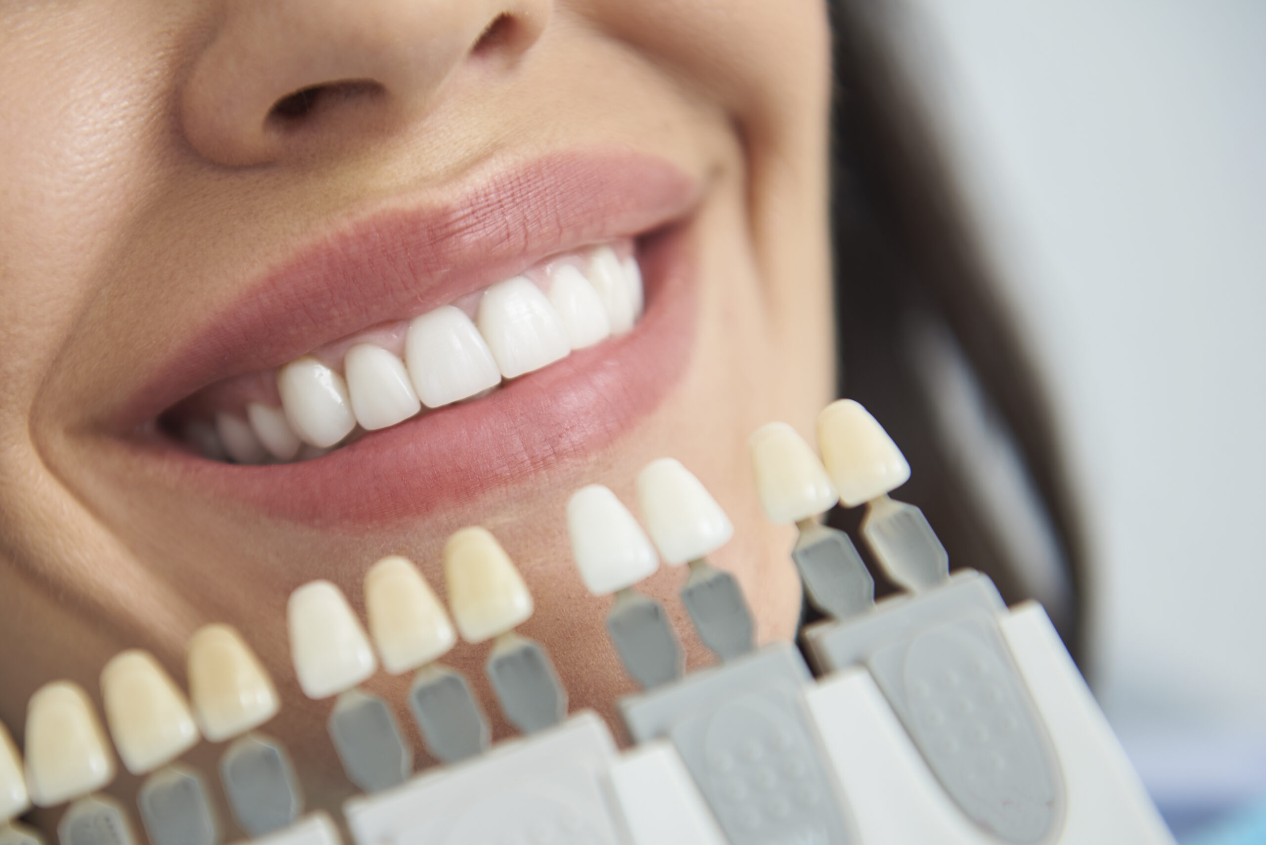 丸わかりガイド ホワイトニング剤の成分 安全性 問題点について 浦和もちまる歯科 矯正歯科クリニック
